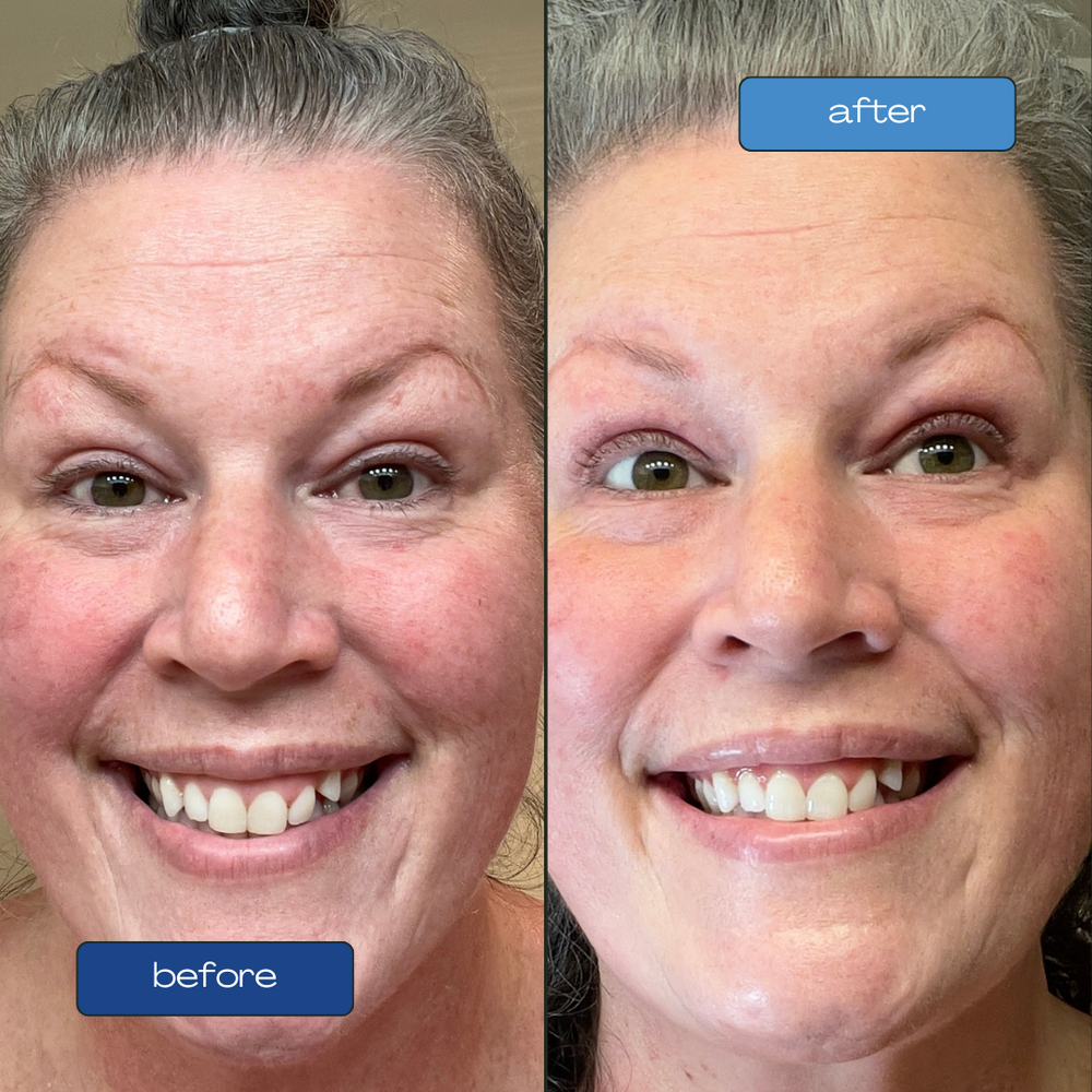 Methylene blue anti aging skincare testimonials bluelene creams